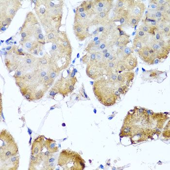 Immunohistochemistry - NIN antibody (144-08215)