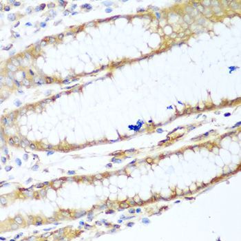 Immunohistochemistry - MYH9 Polyclonal Antibody (144-00173)