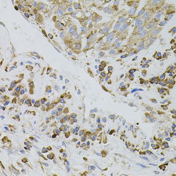 Immunohistochemistry - IRF1 Polyclonal Antibody (144-07692)