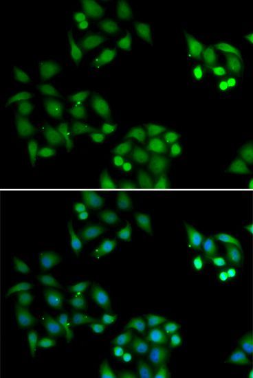 Immunofluorescence - NSFL1C Polyclonal Antibody (144-06677)