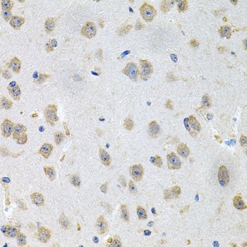Immunohistochemistry - GNE Polyclonal Antibody (144-08570)