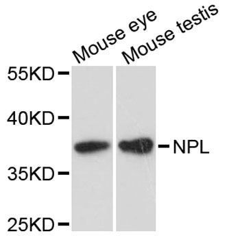 Western blot - NPL antibody (144-09210)
