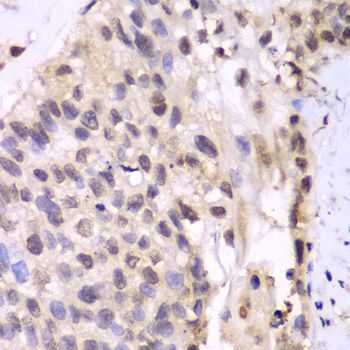 Western blot - PSMA6 Polyclonal Antibody (144-60381)