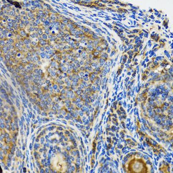 Immunohistochemistry - IRAK4 antibody (144-06208)