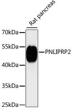 Western blot
