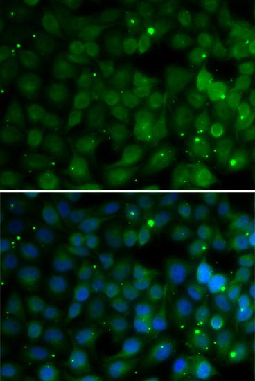Immunofluorescence - HPD antibody (144-06505)