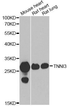 Western blot - TNNI3 antibody (144-06995)