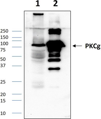 Western blot