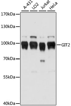 Western blot - GIT2 antibody (144-61018)