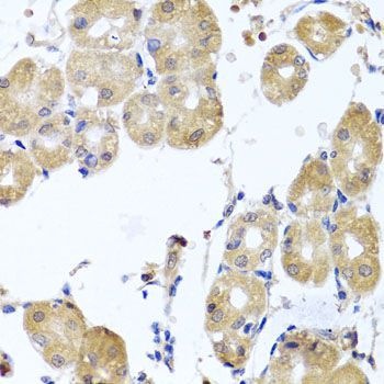 Immunohistochemistry - RHOB antibody (144-02819)