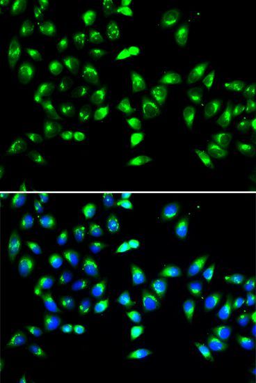 Immunofluorescence - GALNT2 antibody (144-06910)