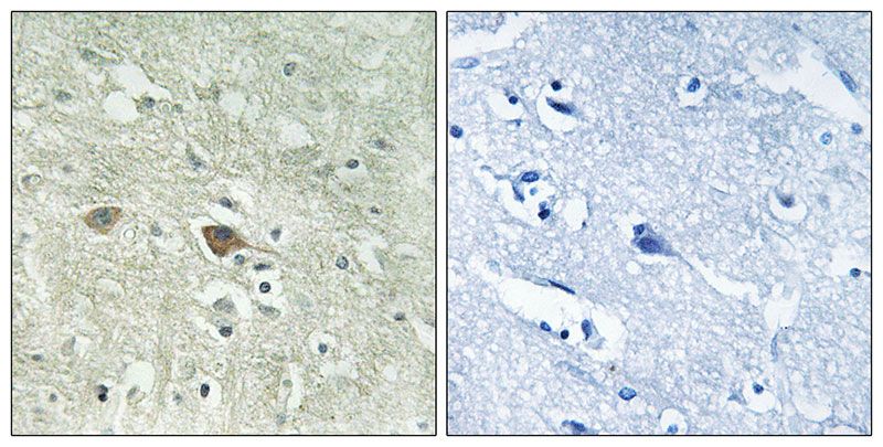 IHC