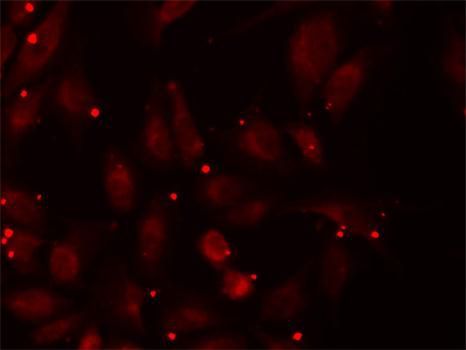 Immunofluorescence - PCCB antibody (144-05415)