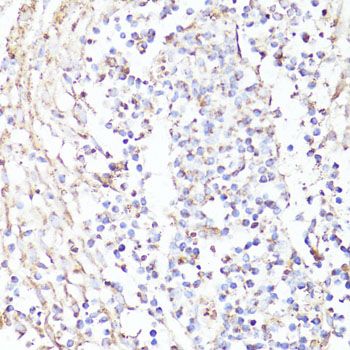 Immunohistochemistry - [KO Validated] ErbB2 Polyclonal Antibody (144-02071)