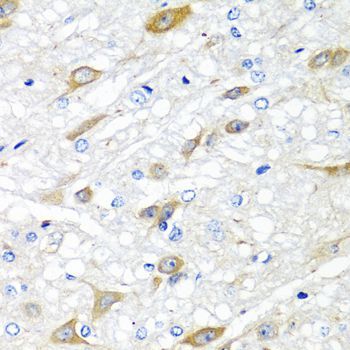 Immunohistochemistry - CPA6 antibody (144-60428)