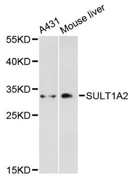 Western blot - SULT1A2 antibody (144-601071)