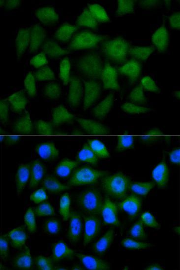 Immunofluorescence - AFP Polyclonal Antibody (144-00200)