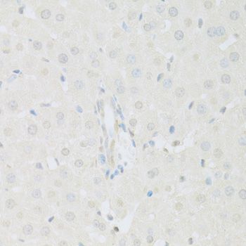 Immunohistochemistry - KAT2A Polyclonal Antibody (144-61334)