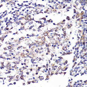 Immunohistochemistry - SELL antibody (144-01622)