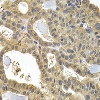 Immunohistochemistry - HSPB8 antibody (144-02514)