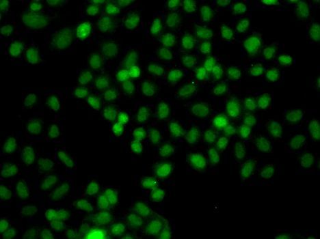 Immunofluorescence - PIP5K1A antibody (144-07941)