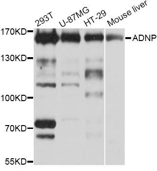Western blot - ADNP Polyclonal Antibody (144-04546)