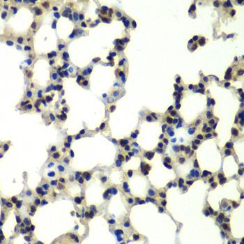Immunohistochemistry - PSMD13 antibody (144-06956)