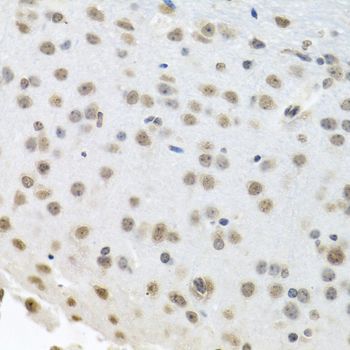 Immunohistochemistry - ELAVL1 Polyclonal Antibody (144-61434)