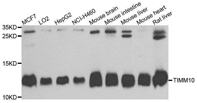 Western blot - TIMM10 antibody (144-04626)