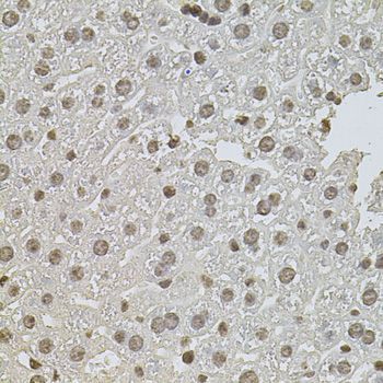 Immunohistochemistry - ZNF408 antibody (144-08512)