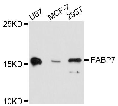 Western blot - FABP7 Polyclonal Antibody (144-011604)
