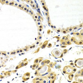 Immunohistochemistry - ATF2 Polyclonal Antibody (144-02155)