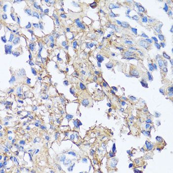 Immunohistochemistry - FN1 antibody (144-12932)