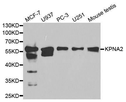 Western blot - KPNA2 Polyclonal Antibody (144-01623)