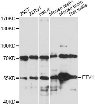 Western blot - ETV1 antibody (144-61447)