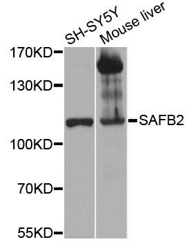 Western blot - SAFB2 antibody (144-012550)