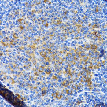 Immunohistochemistry - CHAF1B antibody (144-06259)