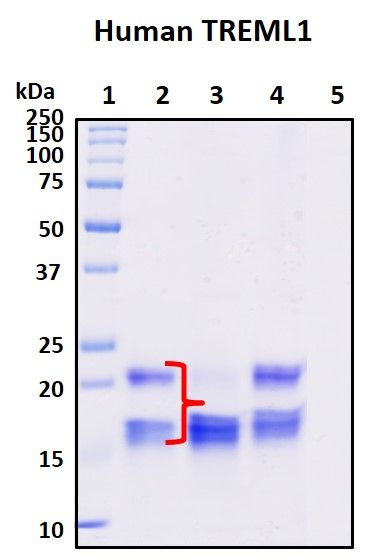 SDS-PAGE