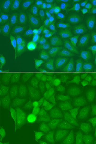 Immunofluorescence - IRAK2 antibody (144-06635)
