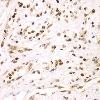 Immunohistochemistry - IKBKB antibody (144-02087)