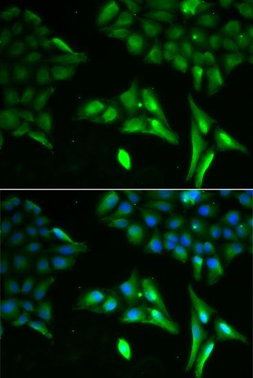 Immunofluorescence - ACADS Polyclonal Antibody (144-60044)