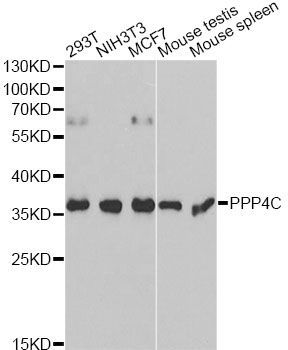 Western blot - PPP4C antibody (144-60378)