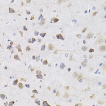 Immunohistochemistry - KPNA4 Antibody (144-02026)