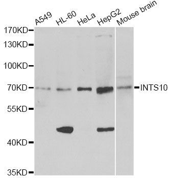 Western blot - INTS10 antibody (144-013419)