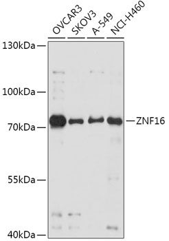 Western blot
