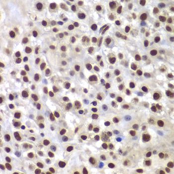 Immunohistochemistry - SMARCB1 Polyclonal Antibody (144-05767)