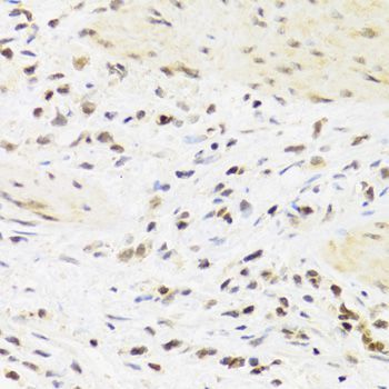 Immunohistochemistry - SUMO4 Antibody (144-03100)