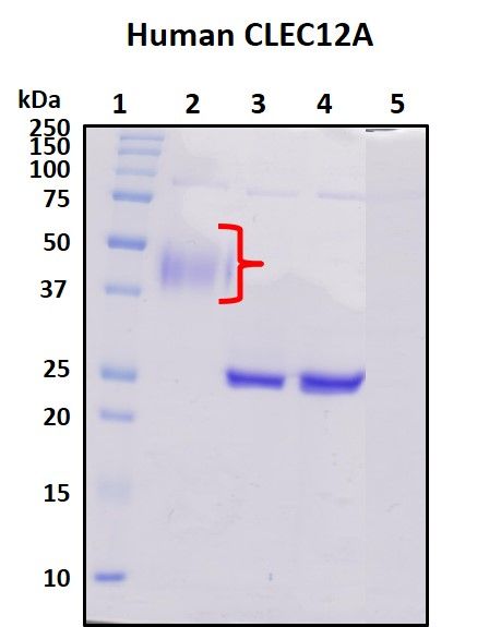 SDS-PAGE