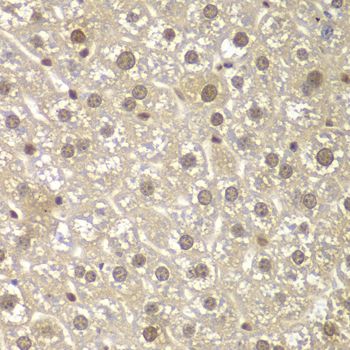 Immunohistochemistry - MAD1L1 antibody (144-01153)