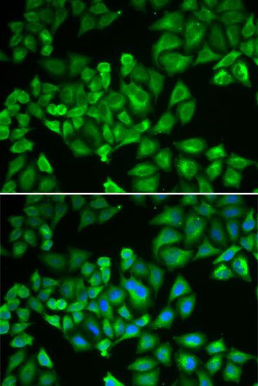 Immunofluorescence - FTL antibody (144-01768)